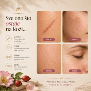 Fleke, ožiljci i akne